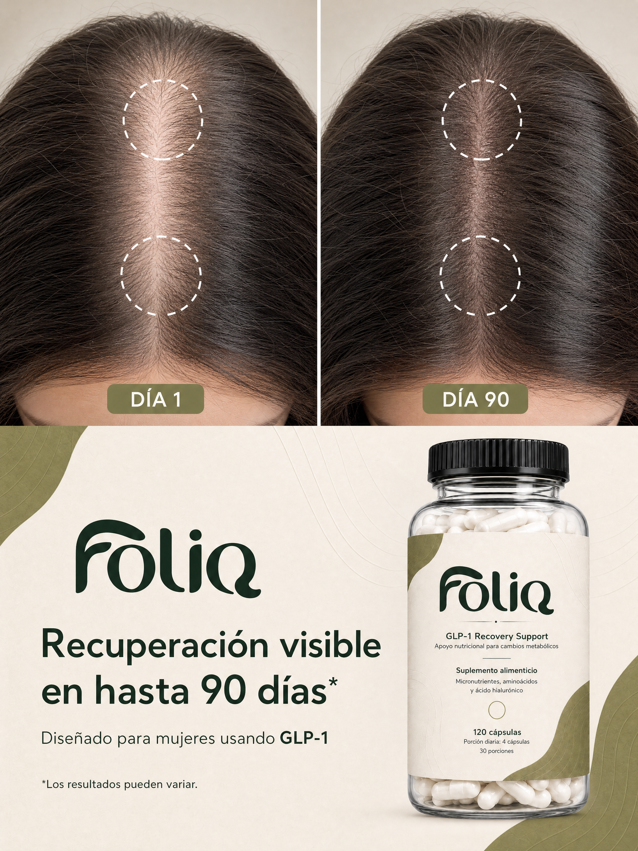 Comparación de recuperación capilar con FOLIQ: día 1 frente a día 90 de protocolo
